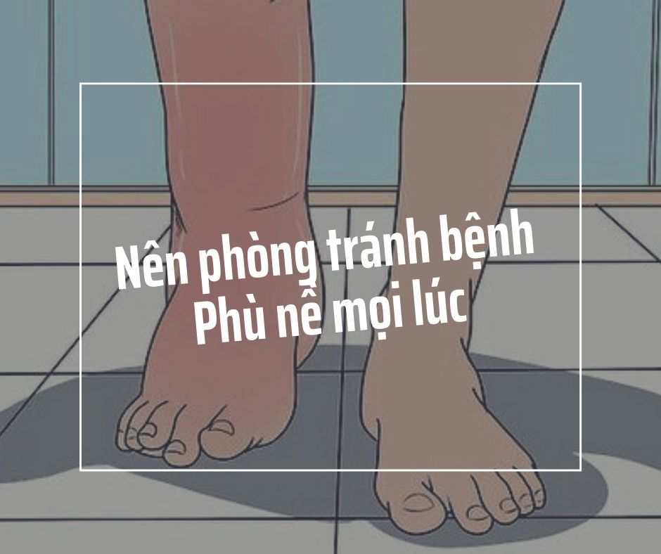 ban nen phong tranh benh phu ne