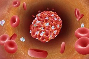 chong huyet khoi la gi