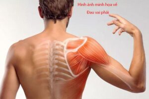 dau vai phai va 13 nguyen nhan pho bien