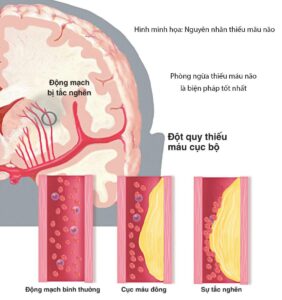 nguyen nhan thieu mau nao