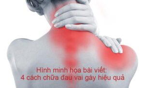 4 cach chua dau vai gay hieu qua