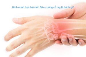 dau xuong co tay la benh gi