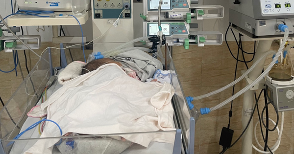 Bé sơ sinh nguy kịch vì mắc virus thường lây qua nụ hôn 1 viem phoi do rssv 586 1695803054166 16958030577491607489454 31 0 504 757 crop 1695804169423921271741