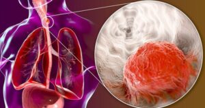 avatar1717339720810 1717339721236194002214