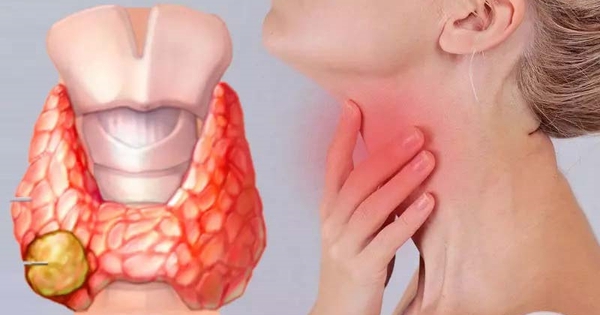 9 câu hỏi thường gặp về bệnh ung thư tuyến giáp 1 avatar1718012938551 17180129388561014585076
