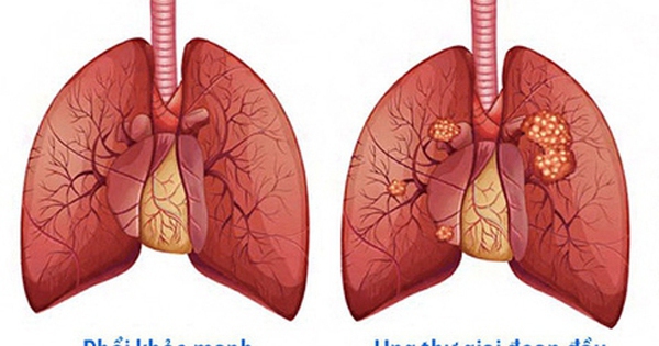 avatar1718534855241 17185348558641774023510