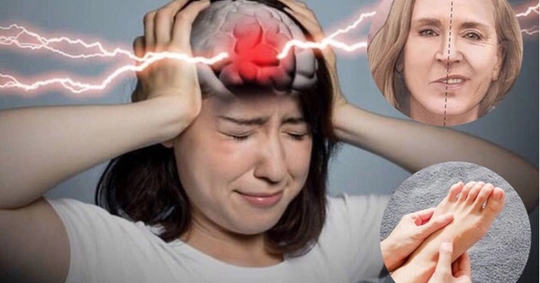 Người phụ nữ 62 tuổi ở Phú Thọ đang khỏe mạnh, bất ngờ bị nhồi máu não sau dấu hiệu phổ biến này 1 co gai22 tuoi bi ung thu mau7 1719374962166997600418 0 0 399 639 crop 1719374979842691169734