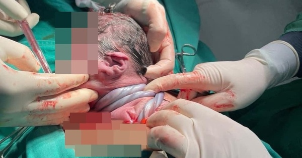 em be chao doi 17186159989091918822656 0 0 600 960 crop 1718616003115280503042