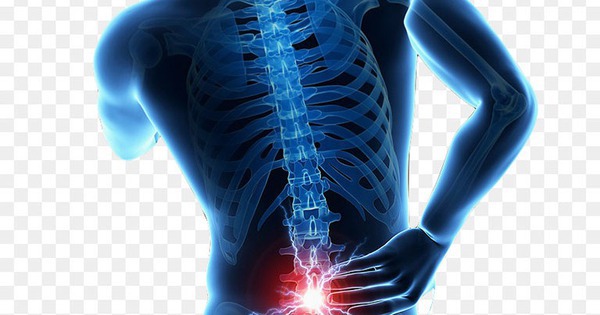 Thoát vị đĩa đệm: Nguyên nhân, biểu hiện, cách điều trị và phòng bệnh 1 avatar1720570445425 172057044582633964958