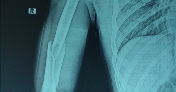 gay tay 1725503321420155950753 392 0 1198 1290 crop 17255034039111723658800