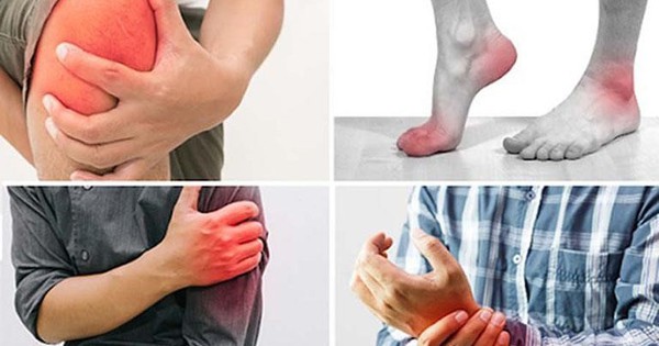 Đau xương khớp khi giao mùa, làm thế nào để giảm bớt triệu chứng? 1 1 1669208796712812923476 1729755493922 17297554945911812065170 0 0 480 768 crop 17297562919571248255874