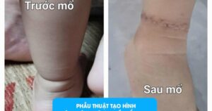 hoi chung vong that1 1729558308945485755537 604 0 1884 2048 crop 1729558919166194000213