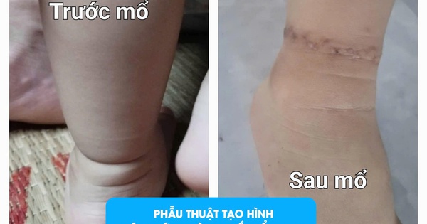 hoi chung vong that1 1729558308945485755537 604 0 1884 2048 crop 1729558919166194000213