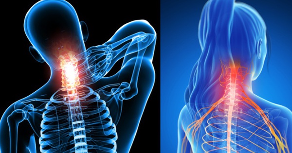 Bé 15 tuổi ở Hòa Bình đột ngột đau dữ dội, liệt tứ chi thừa nhận làm việc này trong lúc chơi game 1 thoai hoa dot song 1728462540579555612718 0 12 528 857 crop 17284625619181844813435