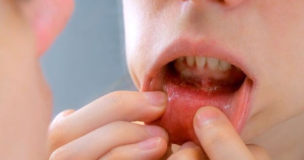 ung thu 2 08232581 1728797561786 17287975624001043230299 0 0 450 720 crop 17287976482371763358027