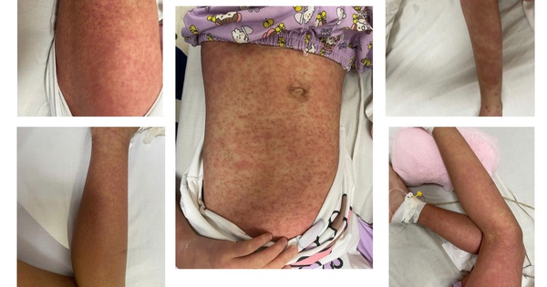 tre xuat hien mam do 1732087977094 1732087978824572011214 296 0 1546 2000 crop 17320882093081527454452