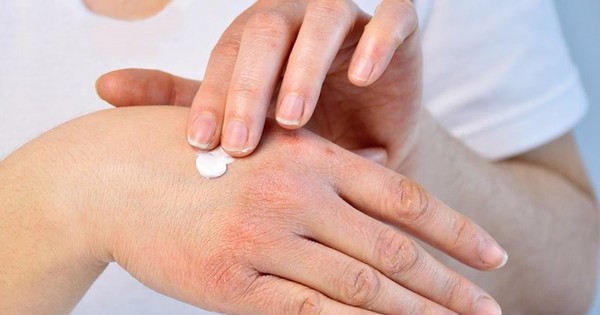 ngua da mua dong 17355567137421534508513 0 0 480 768 crop 17355568922131923836149