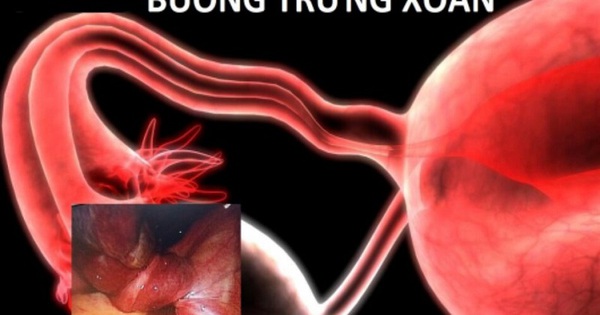 xoan buong trung1 17369306515771025061886 5 0 505 800 crop 17369306853922013810422