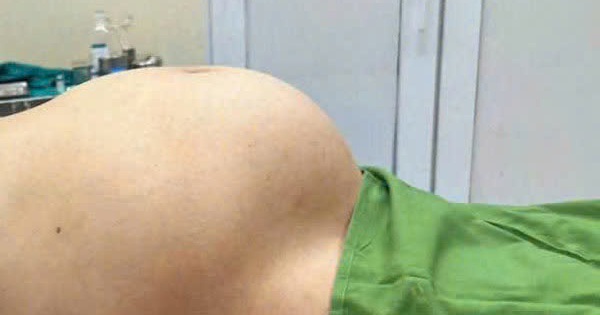 z6189803332470341f0e462355e5c00b0500c139fc7228 1735985030620 17359850319192095442582 55 0 430 600 crop 17359853921432134118046