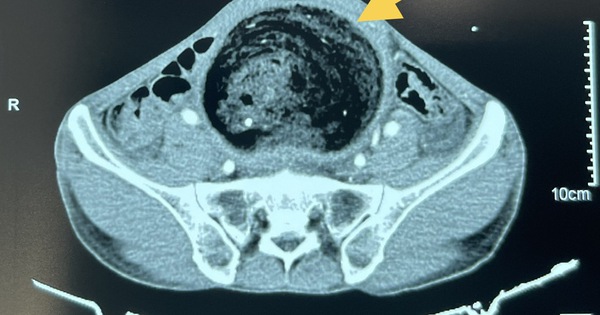 48045427111384726947379362252170832948535430n 17397824873251131102290 323 0 1123 1280 crop 17397828321791944304265