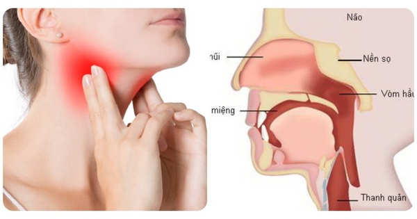 Các yếu tố nguy cơ gây ung thư vòm họng ở phụ nữ 1 avatar1743066972142 17430669724641341182431