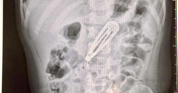 5058510327345889892270015416726780832941609n 17496165850601480128281 253 0 1153 1440 crop 1749616991136874361314