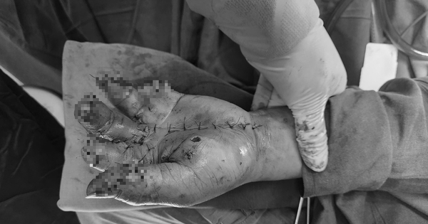 edit z66863751785589f9a6d56fa9b5faa9fcd0ca80d7972df 1749541525440 17495418229161636247966 0 0 1250 2000 crop 1749541830368776076581