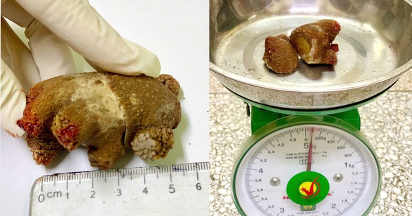 51702159510566796932476683071165536810841363n 1751970943512514649822 0 0 1249 1998 crop 17519709933831998633276