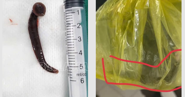 dia 1751963697631535025225 28 0 429 641 crop 17519637496411147118410