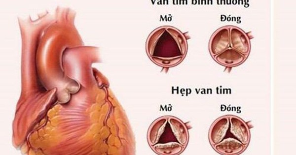 van tim 1753507110403884557287 7 0 320 500 crop 1753507141985120935613
