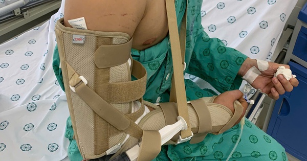 choi vat tay biy bi gay xuong 17544720419971962761164 1085 0 2285 1920 crop 175447207299125723379