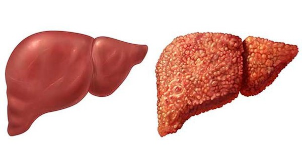 img4887 17558329837771881735300 0 0 388 620 crop 17558329905191780392088