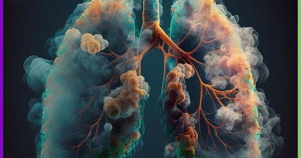 lung cancer hhs united states 17564527459871701225929 117 0 470 564 crop 1756452752339712335533