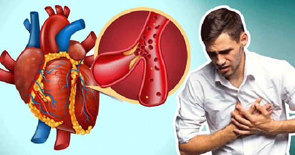 Bệnh nhồi máu cơ tim: Liên tiếp nhiều người bệnh được cứu sống nhờ làm tốt việc này! 1 nhoi mau co tim5 1756197068965676403255 0 21 338 562 crop 17561972899531875178137.gif