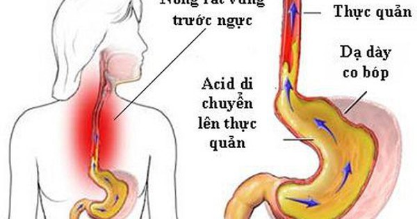 viem thuc quan5 1754644787537574596114 0 0 313 500 crop 17546449849281456405687