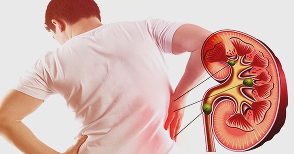 5 dấu hiệu cảnh báo bệnh thận mạn tính: Đừng bỏ qua nếu sáng dậy thấy bất thường này 1 uong bia ruou giup tri soi than niem tin lac loi dua suc khoe vao an tu 1756699874630151249110