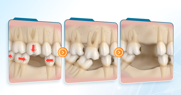 1 1763715130266905961900 24 0 962 1500 crop 17637152414861403250193