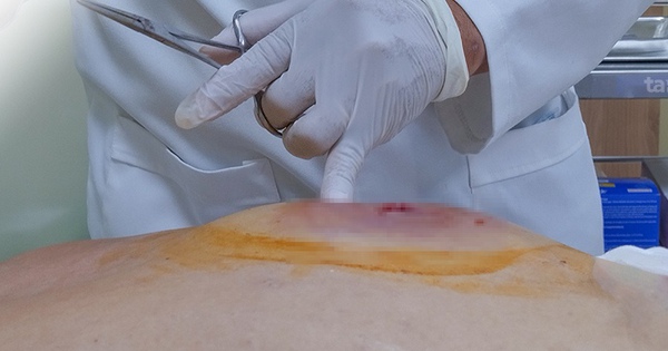 benh tieu duong 176356663829389420040 82 13 565 786 crop 17635670156951531210412