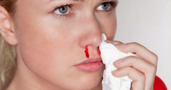 Khô mũi, chảy máu mũi trong ngày hanh khô: Cách chăm sóc và ngăn ngừa hiệu quả 1 chay mau mui 7 17644151891821624185589 0 0 375 600 crop 17644153389981452866701