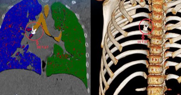 ho keo dai do di vat 1763084095470422370152 0 29 302 512 crop 17630842283561352293799