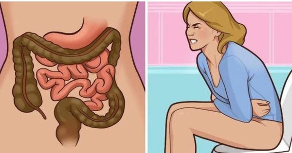 Người đàn ông phát hiện ung thư đại tràng từ dấu hiệu dễ bị nhầm lẫn, rất nhiều người Việt đã bỏ qua 1 ung thu dai trang 1762401090364385182811 0 0 317 606 crop 176240117402863758578