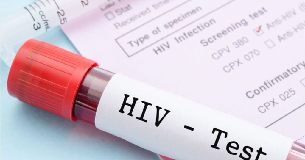 Đi khám vì đau họng dai dẳng, mảng trắng lan nhanh trong miệng, cô gái bất ngờ phát hiện HIV 1 hiv 5 1769766340582582827442 36 0 626 944 crop 1769766360849717798643