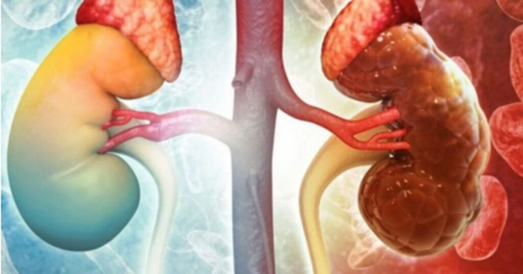 suy than giai doan cuoi 5 1768295272618476319076 0 0 325 520 crop 17682953427961772346754