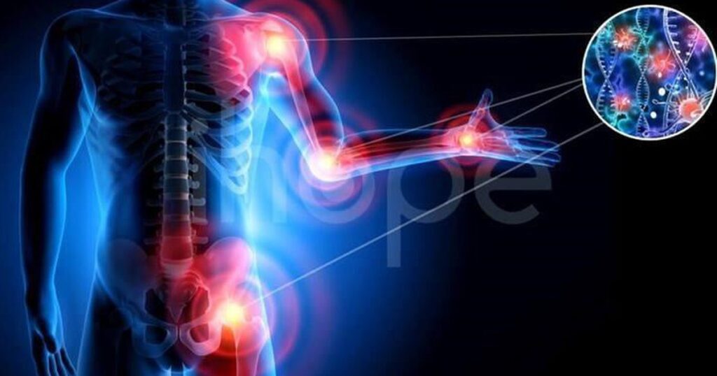 Người đàn ông phát hiện ung thư ác tính hiếm gặp từ dấu hiệu bất thường ở chân 1 ung thu mo mem o chan 1768475015858940071264 0 28 450 748 crop 1768475020375480852290