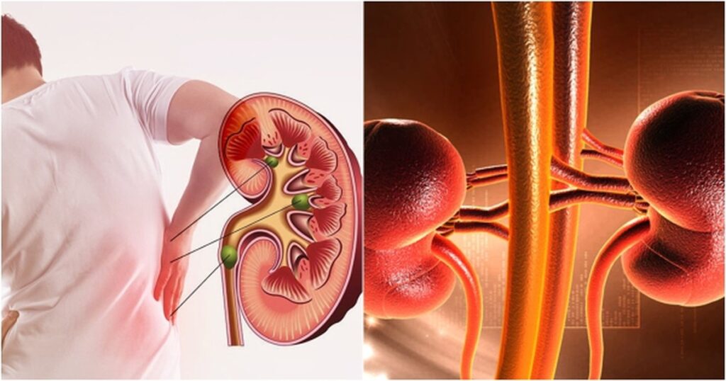 Suy thận tiến triển rất nhanh: 4 dấu hiệu cảnh báo cho người tiểu đường 1 vi sao suy than ngay cang tre hoa nhung dau hieu nhan biet suy than va cach phong ngua 7 1769424328557 17694243287261411076356