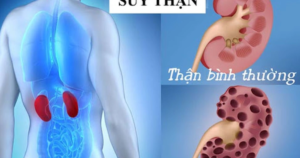 suy than 17698386410061614242300 0 24 404 670 crop 176983878366760218099