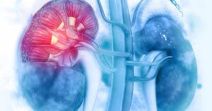 suy than 177019349919393227937 0 12 334 546 crop 17701937226032116029629