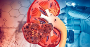 suy than 5 17698368277281370026888 53 0 928 1400 crop 176983695093714844408