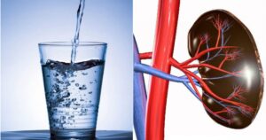 suy than do uong it nuoc 177186371039860647716 0 0 563 900 crop 1771863748160290810731