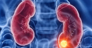 suy than gia doan 3 177116824957076433416 0 0 439 702 crop 17711682906801054934963